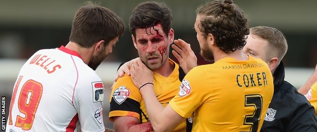 Michael Timlin bleeding